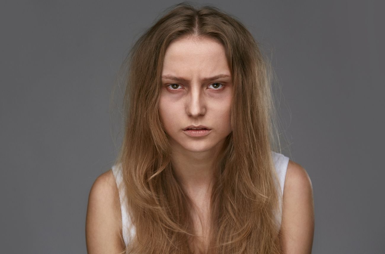 Dark Circles Under the Eyes Treatments, Causes & More cult.fit